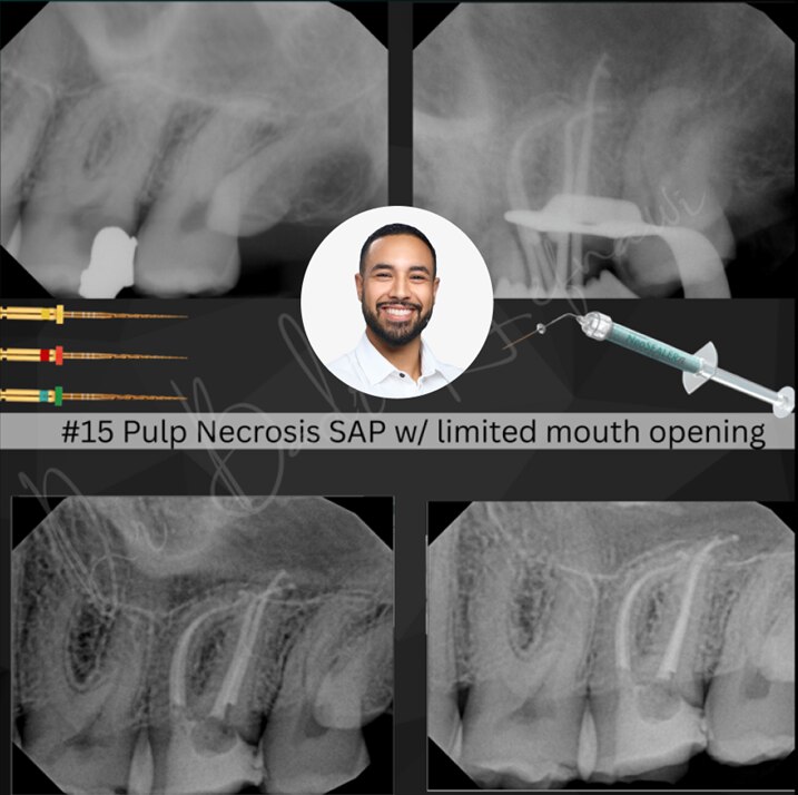 APICES Resident Case Winner